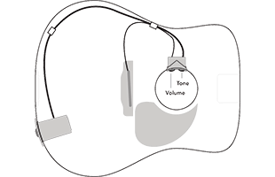 diagram with acoustic guitar body outline showing typical installation and wiring for Fishman Sonitone GT1 pickup system